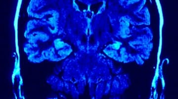 brain, mind, neuroscience, Buddhism, Buddhism and science, neuroscience and Buddhism, Lion's Roar