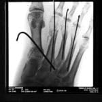 Three Practices That Healed My Heart After A Traumatic Injury
